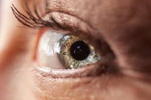 eye ptosis treatment