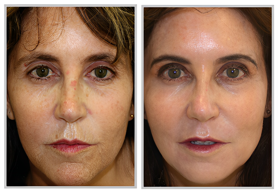 contour trl(1)