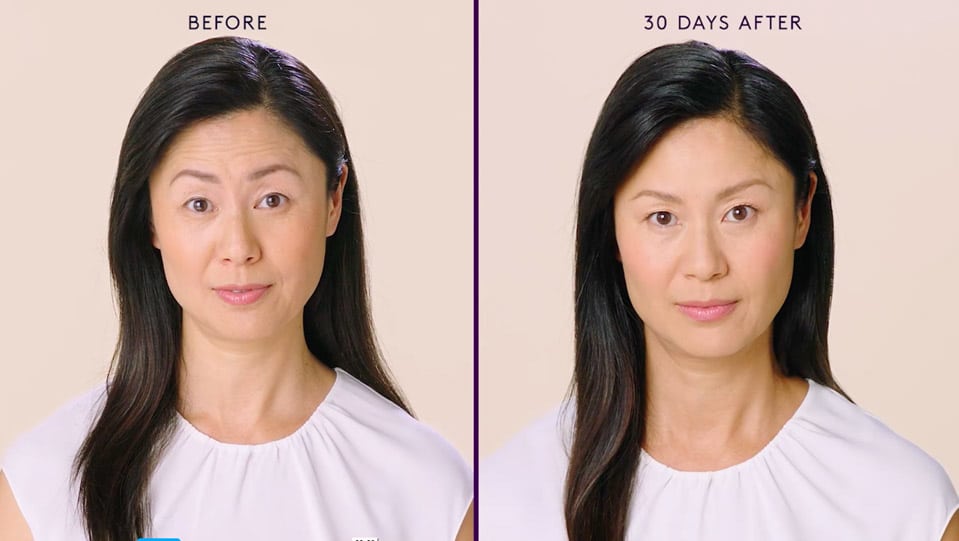 before and after 2