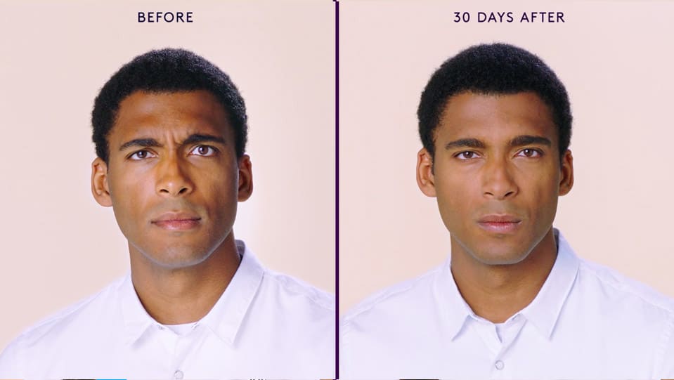 before and after 3