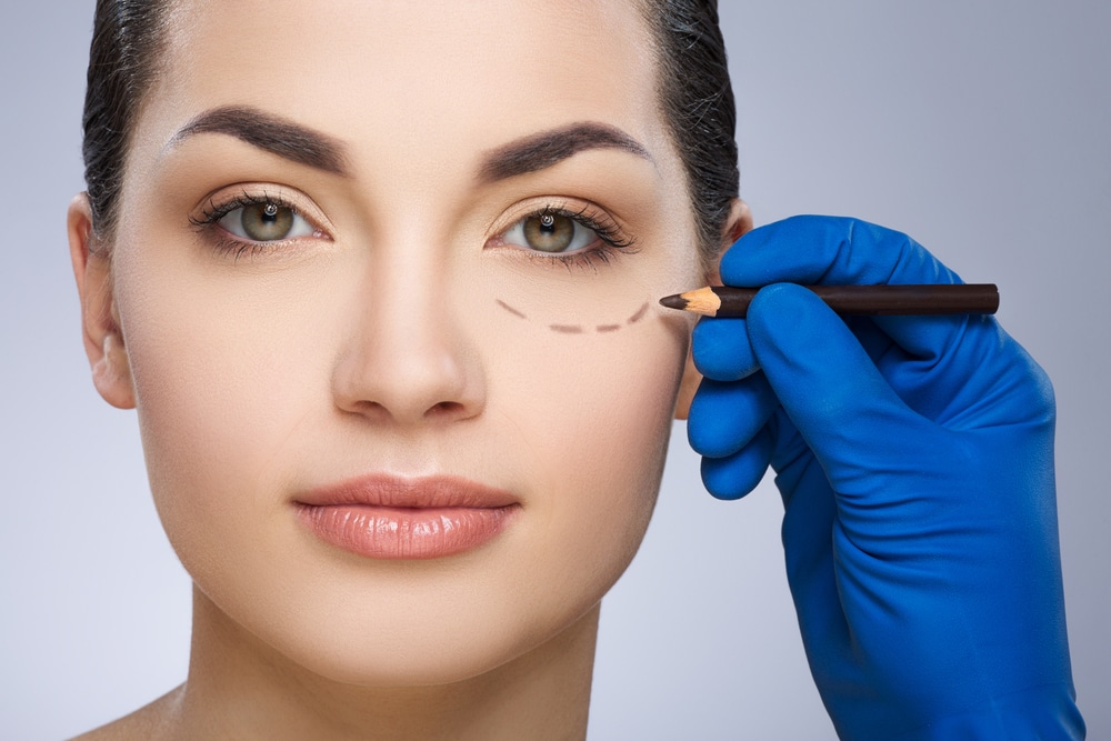 Preparation for blepharoplasty at Rizzuto Eye and Face.